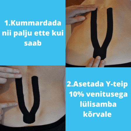 Kuidas paigaldada kinesioteipi erinevate vaevuste korral Borealis Eesti Kuidas paigaldada kinesioteipi erinevate vaevuste korral Borealis Eesti 107706418 3198408506893669 8805242680806454443 n